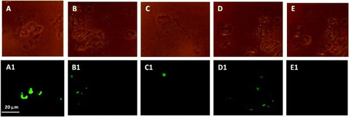 Figure 4.  Granulosa cells phase contrast (Group A, B, and C), and DNA damaged TUNEL positive cells as shown in fluorescent microscopy (A1) Group A; (B1) Group B; (C1) Group C. Further, phase contrast images (D and E) and fluorescent microscopic images (D1 and E1) were positive and negative controls, respectively, used for TUNEL assay.