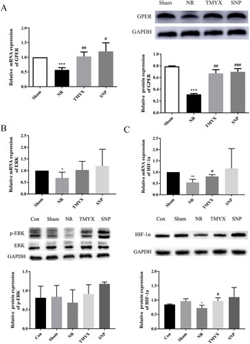 Figure 5. The effects of TMYX on the HIF-1α signaling pathway in NR rats. (A) Effect of TMYX on the expression of the GPER gene and protein in the myocardial HIF-1α pathway of NR rats. (B) Effect of TMYX on the expression of the ERK gene and p-ERK protein in the myocardial HIF-1α pathway of NR rats. (C) Effect of TMYX on the expression of the HIF-1α gene and protein in the myocardial HIF-1α pathway of NR rats. The data are expressed as the mean ± SD; n = 3 animals/group; *p < 0.05, **p < 0.01, ***p < 0.001 vs. Sham group; #p < 0.05, ##p < 0.01, ###p < 0.001 vs. NR group.