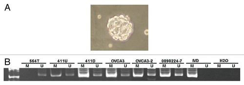 Figure 8 Methylation analysis of RunX1T1 in ovarian cancer initiating cells OCIC. (A) Typical spheroids form after about ten passages of repeating suspension culture from ovarian patient samples. Magnification, 100×. (B) MSP gel image of six OCIC samples isolated from primary ovarian tumor patients. M and U indicates the presence of methylated and unmethylated alleles respectively. The sample names are indicated on the top part. For both reaction, IVD (in vitro methylated DNA) was used as positive control for methylation and water (H2O) was used as a negative control for PCR.