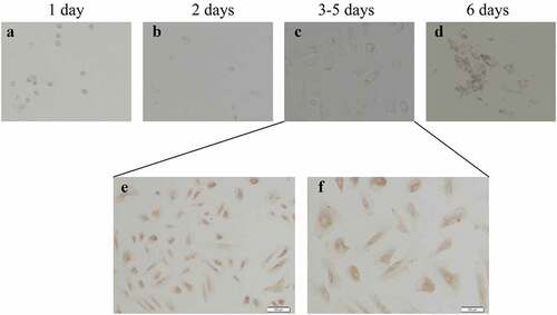 Figure 3. Culture and identification of ovarian GCs in vitro. (a)-(d) represent the situation of GCs cultured in vitro for 1–7 days. (e)-(f) represent the IHC results of GCs staining with FSH antibody during 3–5 days. Scale bar = 100 μm for (e), Scale bar = 50 μm for (f)