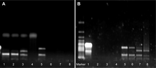 Figure 2 Combining ability and protecting effects of shRNA-NPs by agarose gel electrophoresis.Notes: (A) Serum protection of shRNA nanoparticles (NPs) (lanes 1–4, shRNA-NPs were treated for 1, 4, 8, and 12 hours; lanes 5–8, naked shRNA was treated for 1, 4, 8, and 12 hours). (B) DNase I protection of shRNA NPs (lanes 1–4, naked shRNA was treated for 1, 4, 8, and 12 hours; lanes 5–8, shRNA NPs were treated for 1, 4, 8, and 12 hours).