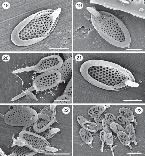 Figs 18–23. SEM images of Synura prowsei. Figs 18–19, 21. Note the shallow posterior rim lacking holes, large and reinforced base plate pores, the stout nature of the forward projecting spines, and the ribs connecting the ends of the posterior rim with the base of the spine. Fig. 20. Two scales with long spines from the anterior portion of the scale (also shown in Fig. 23). Note the large size of the base plate pores on the undersurface of the lower scale. Figs 22–23. Groups of scales. Note the smaller size of the two anterior scales with longer spines (Fig. 23). Figs 20, 22 and 23 are from the holotype specimen. Scale: 1 µm (Figs 18–21) and 2 µm (Figs 22–23).