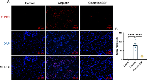 Figure 8 SSF reduces renal tubular cell death in cis-AKI mice. SSF reduces renal tubular cell death in cis-AKI. (A) Representative images of dead tubular cells by TUNEL staining. Magnification: 400×. (B) Counting statistics of dead tubular cells in different groups. All data are shown as mean ± SEM (one-way ANOVA). ****p<0.0001.