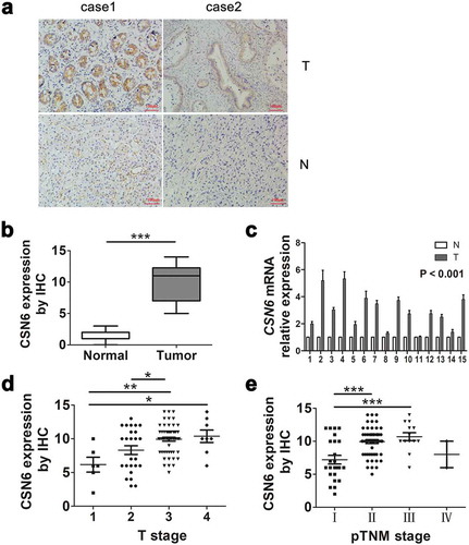 Figure 1. CSN6 protein expression is significantly higher in PDAC tissues than in adjacent non-cancerous tissue. a CSN6 expression in cancer tissues and adjacent non-cancerous tissue (magnification, 200×); T CSN6 expression in PDAC tissues, N CSN6 expression in adjacent non-cancerous tissues. b CSN6 IHC score in cancer tissues and adjacent non-cancerous tissues. c Fifteen representative paired samples of PDAC tissue (T) and adjacent normal tissues (N) were used for real-time qPCR analysis, and CSN6 expression levels were higher in 15 representative paired PDAC samples (p < .001). d The expression of CSN6 in each T stage (tumor infiltration) of PDAC patients (n = 94; T1, n = 6; T2, n = 25; T3, n = 55; T4, n = 8). e The expression of CSN6 in each pTNM stage of PDAC patients (n = 94; Ι, n = 24; ΙΙ, n = 55; ΙΙΙ, n = 12; ΙV, n = 3). Four groups of data were analyzed using ANOVA with post-test. PDAC, pancreatic ductal adenocarcinoma; CSN6, constitutive photomorphogenesis 9 (COP9) signalosome 6; qPCR, quantitative real-time PCR; IHC, immunohistochemistry. *P < .05; **P < .01; ***P < .001.
