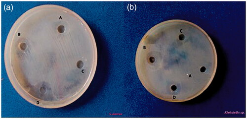 Figure 10. Antibacterial activity of AgNP against the well containing: (a) Gram-positive bacteria Staphylococcus aureus (S. aureus) and (b) Gram-negative bacteria Klebsiella pneumoniae (K. pneumoniae). A: double distilled water; B: streptomycin; C: Cyanthillium cinereum extract; D: AgNP.