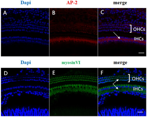 Figure 1. Localization and expression of AP-2 and myosin Ⅵ in adult mouse cochlea. Panels A-C show AP-2 labeling (red) and DAPI staining (blue). AP-2 (B) was highly expressed in IHCs but not in OHCs and intensely expressed in the synaptic regions of IHCs (C). D-F shows the dual labeling of myosin Ⅵ (green) and DAPI staining (blue). myosin Ⅵ (E) was highly expressed in both IHCs and OHCs, mainly in the cytoplasmic regions of the cells. Scale bar = 20 µm.