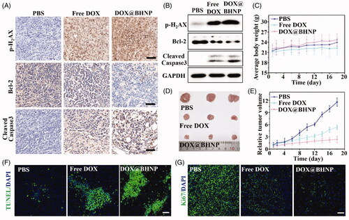 Figure 6. (A) Immunohistochemistry and (B) western blot assay of p-H2AX, Bcl-2, and cleaved caspase-3 expression in the tumor tissues. (C) Average body weight of the mice in the different treatment groups during the experimental period. (D) Photographs of tumors isolated from the different groups on the 18th day after different intravenous administration of the treatments. (E) Relative tumor volume in the mice after the intravenous administration of different treatments during the experimental period. (F, G) Representative histological analysis images of TUNEL and Ki67-stained tumor sections obtained on the 18th day after treatment. The mice were treated with PBS, free DOX, and DOX@BHNP. Scale bar: 50 µm. Data are reported as mean ± S.D.