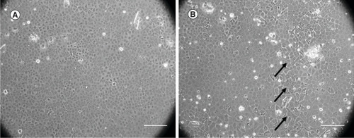 Figure 3. Human corneal endothelial cells from young and older donors. (A) Human corneal endothelial cells from the young donor showed homogeneous hexagonal morphology. (B) Human corneal endothelial cells from older donor showed polymegathism and pleomorphism. The polymorphic cell is marked with black arrows.Scale bar = 250 μm.