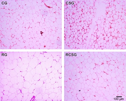 Figure 6 Representative photomicrographs of epididymal adipose tissue stained with hematoxylin and eosin.