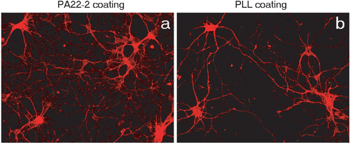 Figure 4. Comparable cultures of hippocampal neurons after 14 days in culture on PA22-2 (a) and PLL (b) coated gold substrates. More neurites are apparent on the PA22-2 coated surface.