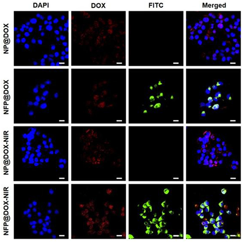 Figure 4 In vitro cellular uptake and drug release. CLSM images of CAL-27 cells treated with NP@DOX or NPF@DOX with or without 808 nm NIR irradiation (1.0 W/cm2) to evaluate cellular uptake. Scale bar: 20 µm.