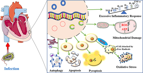 Figure 1 Mechanisms of myocardial injury induced by sepsis.