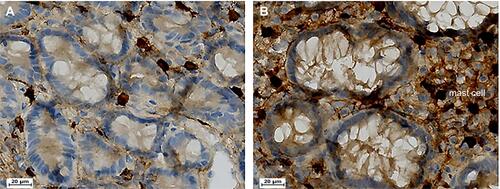 Figure 2 Immunohistochemical results of tryptase-positive MC (× 400). (A): Tryptase-positive mast cell (MC) in the normal subject (× 400); (B) Tryptase-positive MC in the patient with IBS-D (× 400). The positive cells manifested brown or yellow stained.