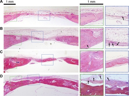 Figure 8 Histological sections stained with H&E.Notes: Scaffolds in different groups were implanted at the calvarial defects for 8 weeks. (A) No implant. (B) SCS/P scaffold. (C) i/SCS/P containing 100 ng irisin. (D) i/SCS/P containing 200 ng irisin. The first panel images showed the whole view of the operation site. Higher magnification (×25) of the boxed area is displayed for margin of the defects (green dotted lines) and center of the defects (blue dotted lines). Black arrows represent new blood vessels and endotheliocytes.Abbreviations: SCS/P, silk/calcium silicate/sodium alginate/PVA; i/SCS/P, irisin-loaded silk/calcium silicate/sodium alginate/PVA.