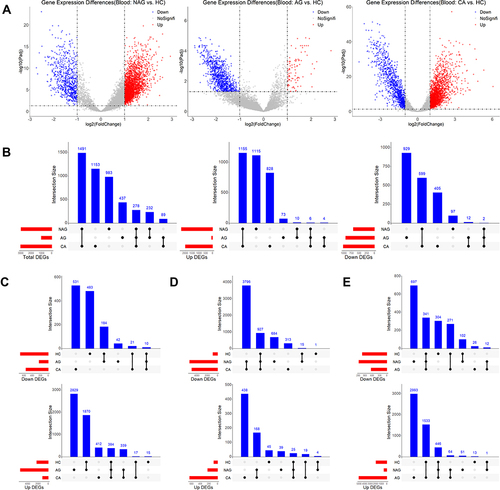 Figure 1 Gene expression changes in gastritis-cancer transformation. (A) DEGs obtained by comparing NAG, AG and CA with HC, respectively. (B) Overlap analysis between DEGs from different stages. (C) Staged DEGs in NAG. (D) Staged DEGs in NAG. (E) Staged DEGs in CA.