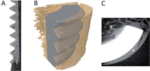 Figure 4. Micro-CT images. A. Longitudinal section of the data set with implant in white and bone in gray. B. Overlay image of contrast-segmented part of implant (gray) and bone (yellow; transparent) showing the osseointegration. C. Transaxial section of the data set with implant in white and bone in gray. The outer surface was dominated by cortical bone (*) and the inner surface was dominated by trabecular bone (#).