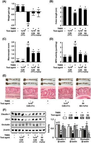 Figure 2. Effects of C29 and sulfasalazine on body weight (A), macroscopic disease (B), colon length (C), colonic MPO activity (D), histological examination (E), and tight junction proteins (F) in mice with TNBS-induced colitis. All data are mean ± SD (n = 6). #P < .05 vs. normal control group. *P < .05 vs. group treated with TNBS alone.