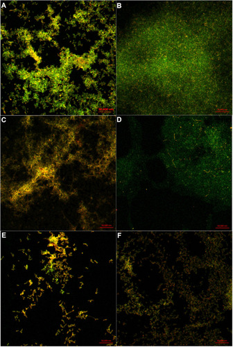 Figure 7 Distribution of polysaccharides and dead cells in cordycepin-treated biofilms. (A), (C) and (E) show the distribution of EPS (green) and dead cells (red) in biofilms treated with 0, 0.031, and 0.125 mg/mL of cordycepin. (B), (D) and (F) show the distribution of EPS (green) and dead cells (red) in mature biofilms treated with 0, 0.125, and 0.5 mg/mL of cordycepin.