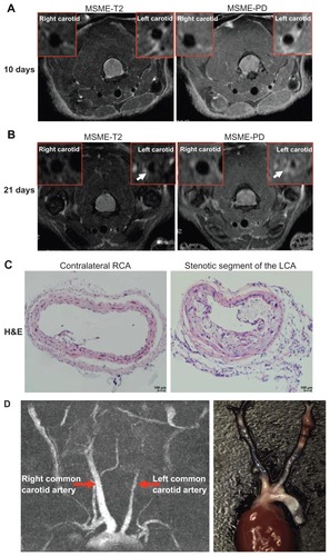 Figure 2 Identification of neointima formation in apoE−/− mouse using in vivo MRI and the corresponding histology. (A) Example of MR images at day 10 following perivascular collar placement. MRI of a mouse with slight stenosis of the left carotid artery. The image shows an in vivo image of a transverse section at the RCA and LCA after perivascular collar placement using MSME proton-density/T2-weighted sequences. (B) Example of MR images at day 21 following perivascular collar placement. MRI of a mouse with significant stenosis of the left carotid artery. LCA with a neointima formation reveals a stenostic lumen, white arrows indicate aortic stenosis. (C) Corresponding H&E stain obtained in a mouse at 21 days following perivascular collar placement. Representative photomicrographs showing hematoxylin and eosin stained cross sections of proximal carotid site (H&E staining, 20×). (D) Representative carotid artery tree image in mice acquired at 7 T using 3D-FLASH sequence. The longitudinal view shows the characteristic stenosis of the left carotid artery.Abbreviations: H&E, hematoxylin-and-eosin; LCA, left carotid artery; MR, magnetic resonance; MRI, magnetic resonance imaging; MSME, multi-spin multi-echo; RCA, right carotid artery.