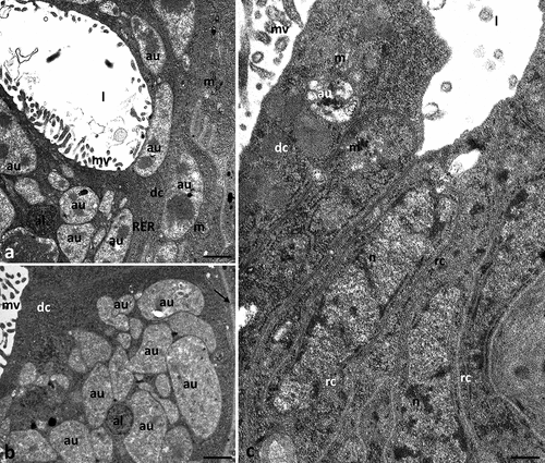 Figure 5. Midgut of Pam. experimentalis treated with ibuprofen for 28 days; concentration of ibuprofen 0.1 μg/L – Ib2a, TEM. (a–b) the ultrastructure of the midgut digestive cells in the group Ib2a, (a) bar = 0.15 μm, (b) bar = 0.30 μm. c) the ultrastructure of the midgut regenerative cells in the group Ib2a, bar = 0.28 μm. Abbreviations: autolysosome (al), autophagosome (au), digestive cell (dc), regenerative cell (rc), mitochondrion (m), nucleus (n), rough endoplasmic reticulum (RER), microvilli (mv), midgut lumen (l), basal lamina (black arrow).