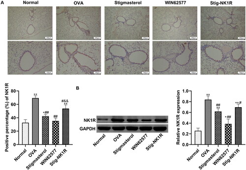 Figure 7. Stigmasterol decreased the expression of NK1-R in lung tissues of OVA rats by immunohistochemical staining (A) and western blot (B). Micrographs depict representative tissues at 100× and 200× magnification. These images were analyzed by Image J.49p. *p < 0.05, **p < 0.01, normal; #p < 0.05, ##p < 0.01, OVA; &&p < 0.01, Stigmasterol. n = 5.