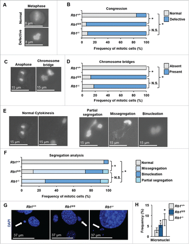 Figure 4. Defective mitosis in Rb1S/(S)mutant cells. Mitosis was investigated by video microscopy using MEFs transduced with H2B-GFP (Rb1+/+ n = 19, Rb1S/S n = 15, Rb1−/− n = 11). Proportions of mitotic errors were compared using a χ2 test with significant differences indicated by an asterisk, while N.S. denotes comparisons that were not significantly different. Scale bars indicate relative magnification for all images. (A) Merged images of phase-contrast and GFP channels display examples of normal and defective chromosome congression in metaphase. (B) Quantitation of the frequency of congression errors observed per genotype. (C) Merged images of phase-contrast and GFP channels distinguish a normal anaphase cell from a cell that exhibits a chromosome bridge. (D) Quantitation of the frequency of chromosome bridges observed per genotype. (E) Merged images of phase-contrast and GFP channels to demonstrate examples of defective chromosome segregation and cytokinesis observed by video microscopy. (F) Quantitation of defective segregation events observed per genotype. (G) Fluorescence microscopy of proliferating MEFs stained with DAPI (blue). White arrows demark examples of micronuclei while scale bars indicate relative magnification. (I) Quantitation of micronuclei visualized by immunofluorescence microscopy. Error bars indicate one standard deviation from the mean, and an asterisk represents a significant difference from wild type (P ≤ 0.05 by t-test, n = 3).