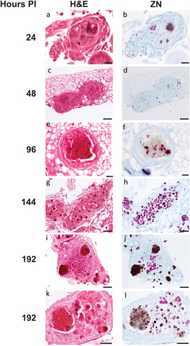 Figure 4. Histological analysis of Gm-H37Rv infection. Histological tissue sections of larvae infected with H37Rv (2 x 106 CFU) were prepared and processed for H&E (a, c, e, g, i, and k) or ZN (b, d, f, h, j, and l) staining. Granuloma-like structures (GLS) were visualised at 24 h (a, b), 48 h (c, d), 96 h (e,f) 144 h (g, h) 192 h (i-l) post-infection. The complexity of host cell arrangement forming the GLS varied from (a, b) organised to (c, d) unstructured. The physical state of H37Rv bacilli contained within the GLS varied over time with mixtures of individually distinct active clusters of bacilli of varying size (bright pink) or densely packed highly ZN-reactive amorphous material released from dead/dying bacilli (dark purple). Loss in ZN affinity (grey mass) was observed in structures 96 h pi onwards (f, j, l). Cell necrosis, visible in H&E stained sections characterised by cellular fragmentation, loss/fading of nuclear staining, and decreased staining (due to appearance of pale spongy pockets) were observed in the areas associated with densely packed ZN reactive material. Scale bars represents 20 μm for a, b, e, and f; 100 μm for c, d and g-j; 50 μm for k and l.