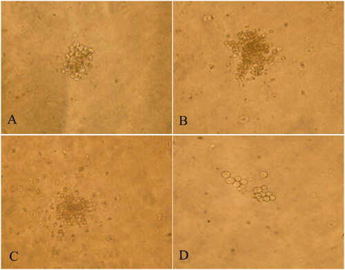 Figure 3. Culture of bone-marrow haematopoietic progenitor cells. (A) CFU-E, (B) BFU-E, (C) CFU-GM, and (D) CFU-Meg. Normal control, unstained (200×).