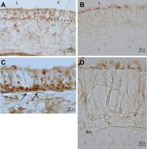 Figure 2 Immunohistochemical staining for MT-1A protein in bronchial epithelium. Left side micrographs reveal the expression of MT-1A in the basal cell layer of control group airway epithelium (arrow, A and C). Right side micrographs show MT-1A expression in SM-injured airway epithelium (B and D). Note the immunoreactivity of MT-A1 in the control group is higher and wider than in the SM-injured samples. In the high and same magnification the epithelium layer thickness in SM-injured is much thicker than control group (C and D).