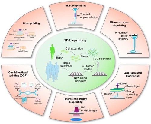 Figure 5 3D bioprinting technology and its types.Abbreviations: 3D, three-dimensional; UV, ultraviolet.