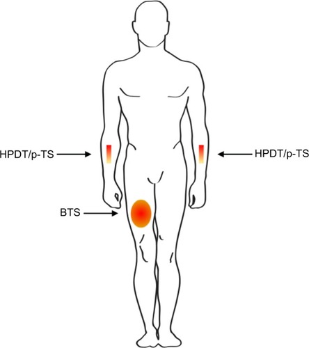 Figure 1 Anatomical location of pain model testing.