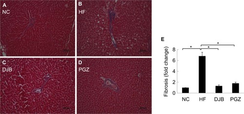 Figure 5 Masson’s trichrome stain for collagen bundle.