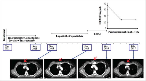 Figure 2. In case 2, CT images showed a continuously increase of the right chest wall metastasis during multi-anti-HER2 targeted therapy and a remarkable decrease after treatment of pembrolizumab plus albumin-bound paclitaxel with the reduction of serum HER2 ECD levels.