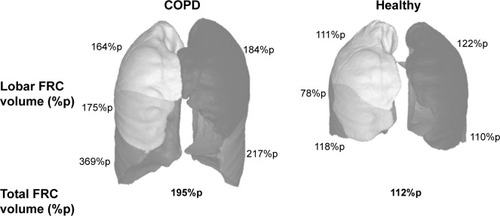 Figure 3 Regional hyperinflation at the FRC level for a COPD patient from the roflumilast trial and a healthy volunteer (both female, both 170 cm in height).