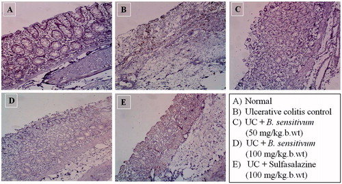 Figure 8. (A) Immunohistochemical localization of iNOS in normal control, (B) positively stained brown granules for iNOS were significantly increased in both number and intensity in colonic tissue of acetic acid treated rats. (C and D) B. sensitivum (50 or 100 mg/kg b wt) and (E) sulfasalazine (100 mg/kg b wt) treated reduced colonic iNOS expression of acetic acid-treated rats.