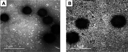 Figure 1 Transmission electron microscope (TEM) micrographs of prepared acetazolamide loaded nanovesicles. (A) TEM micrograph of F2 (Span 60:Tween 80 ratio 80:20). (B) TEM micrograph of F5 (Span 60:sodium deoxycholate ratio 80:20).Abbreviations: F, formulation; Span 60, sorbitan monostearate.