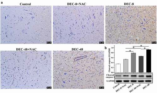 Figure 5. NAC attenuates apoptosis in rats with SCI treatment for 2 months after decompression surgery. (A) TUNEL staining and (B) protein expression of cleaved caspase-3 in injured spinal cords. Data presented as mean ± SD, n = 3, *p < 0.05. Scale bar = 50 μm.