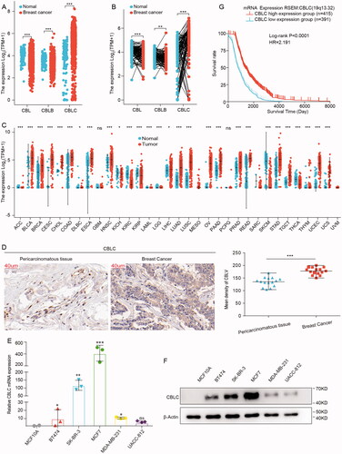 Figure 1. CBLC expression in breast cancer tissues and cells. (A,B) mRNA expression levels of CBL, CBLB and CBLC in paired (A) and unpaired (B) breast cancer samples from TCGA database. (C) mRNA expression level of CBLC in pan-cancers. (D) IHC images showing the expression and location of CBLC in 15 breast cancer tissues and 15 para-carcinoma tissues. CBLC expressions were converted to H-score. (E,F) mRNA (E) and protein (F) expression levels of CBLC in five breast cancer cells and normal breast epithelial cells. *p < 0.05 (normalized to MCF10A cells). (G) Kaplan-Meier Curve shows the overall survival of breast cancer patients with different CBLC expression levels.