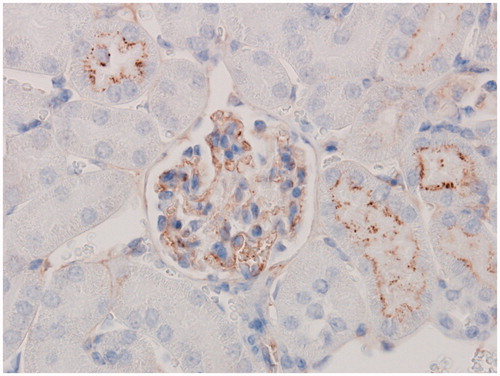 Figure 4. IC-associated granular staining containing C3d. Immunohistochemical staining with anti-mouse C3d showed IC associated granular deposits containing mouse C3d in glomeruli from a C57BL/6J mouse administered 10 mg/kg BSA SC for 13 weeks in dose-finding study. Original objective 60×.