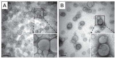 Figure 2 Transmission electron microscopic images of siRNA-loaded liposomes. (A) siRNA-loaded 1 mol% PEGylated liposomes. (B) siRNA-loaded 1 mol% PEGylated, RGD peptide-modified liposomes. The images were taken at 50,000× magnification from the suspended liposomal particles after negative staining. In the bottom-right corner, the local image was enlarged to view the interface of liposomes clearly. Bar = 0.2 μm.Abbreviations: siRNA, small interfering RNA; PEG, polyethylene glycol.