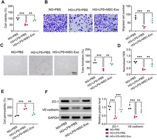 Figure 4. MSC-Exo attenuated HG + LPS-induced HPMECs dysfunction. HPMECs were co-incubated with MSC-Exo and then induced using HG and LPS. Cell viability, migration, angiogenesis and TER were detected using CCK8 (a), transwell assay (B), tube formation assay (C) and TER assay (D). (E) FITC-dextran assay was used to test cell permeability. (F) WB analysis for detection the protein levels of ZO-1 and VE-cadherin. **p < 0.01; ***p < 0.001.