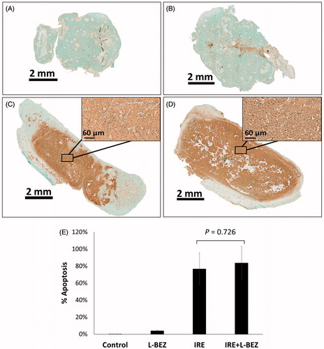 Figure 5. Tumor apoptosis three days after treatment using TUNEL Staining. Representative tumor sections from the (A) control group; (B) L-BEZ group; (C) IRE group; and (D) IRE + L-BEZ group. The tumors treated with IRE and IRE + L-BEZ had higher mean apoptosis percentages than did the tumors in the other groups. The insets in (C) and (D) illustrate that the dark apoptosis-positive signal was not confined in the nuclei but spread out to the cytosol and in some intratumoral space. (E) Comparison of percentage of apoptosis by TUNEL staining (one-way ANOVA followed by Holm-Šidák post-hoc analysis, p values between: CTL and LBEZ, .671; CTL and IRE, < .001; CTL and IRE + LBEZ, <.001; LBEZ and IRE, <.001; LBEZ and IRE + LBEZ, <6.001;and IRE and IRE + LBEZ, .726).