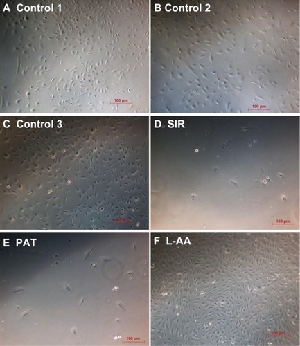 Figure 4 Phase contrast images of ECs for L-AA, SIR, PAT, and controls (A–F) (scale bar indicates 100 μm).