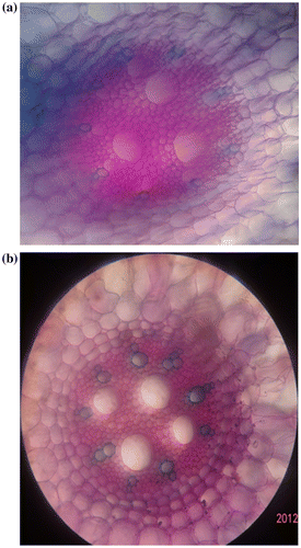 Figure 3. Cross section of the root of (a) regenerated plantlet from somatic embryo; (b) mother plant (×10).