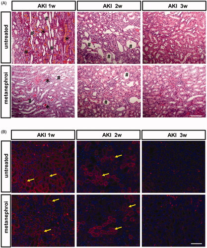 Figure 4. Effect of metanephroi microenvironment on renal injury in rats subjected to glycerol-induced AKI. (A) Representative morphological changes in the kidney assessed by H&E staining at different time points between the glycerol and the metanephroi groups. *, myoglobin cast. #, denotes necrotic tubules (B) KIM-1 levels at different time points between the glycerol and the metanephroi groups were analyzed by immunofluorescence. KIM-1-positive staining (Red fluorescence) was observed on the proximal tubular epithelial cells and damaged tubules (arrows). Bars: 100 μm.