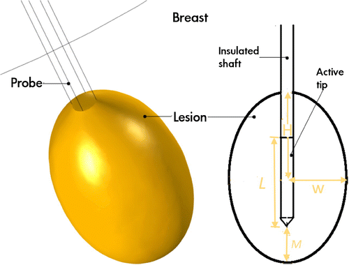 Figure 4. Lesion parameters