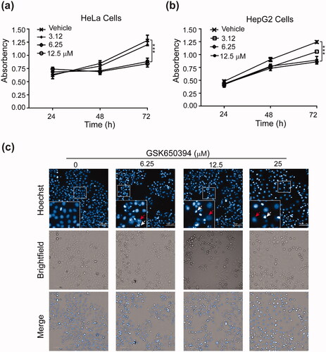 Figure 3. GSK650394 suppresses cancer cells proliferation. (a, b) MTT cell proliferation assay for HeLa (a) and HepG2 (b) cells. Cells were treated with indicated concentrations of GSK650394 for 24–72 h. After incubation with MTT solution, the number of viable cells was determined by measuring the absorbance at 490 nm. Values are means ± SD, n = 5. ***P < 0.001 vs. vehicle. (c) Effect of GSK650394 on the nuclear morphology of HeLa cells. Cells were treated with indicated concentrations of GSK650394 for 48 h and the nuclei were stained with DAPI. Outlined regions were magnified and shown in the left bottom corner. Red arrows indicated the expanded nuclei and white arrows for cell debris.