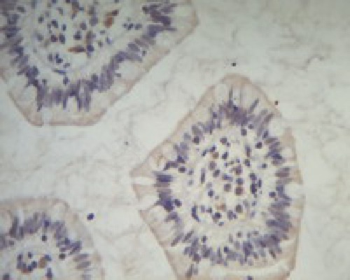 Figure 5 Negative expression of Piwil1 in para-carcinoma tissue, ×400.