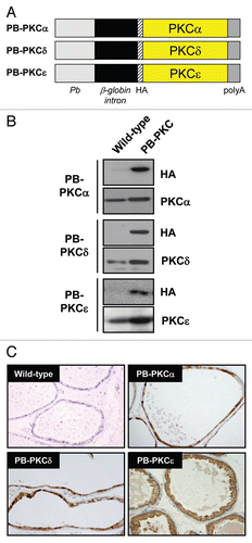 Figure 1 Generation of PB-PKC transgenic mice. (A) Schematic representation of transgenic constructs. The cDNAs for PKCα, PKCδ or PKCε were ligated into a PB promoter vector adapted to express proteins fused to an N-terminal HA-tag. (B) Western blot showing the expression of PKC transgenes in mouse prostates. Protein extracts from prostates obtained from 4 month-old mice were analyzed by western blot using an anti-HA epitope antibody and specific anti-PKC isozyme antibodies. (C) Prostates from homozygous PB-PKCα, PB-PKCδ and PB-PKCε, as well as control (wild-type) mice at 4 months were obtained and subjected to IHC using an anti-HA antibody. Representative HA stainings in the VP are shown.