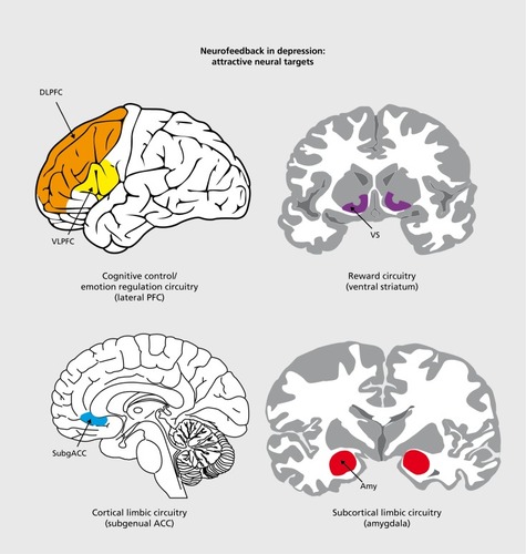 Figure 3. Cognitive-affective brain systems that could become targets for neuromoduiation in depression. DLPFC, dorsolateral prefronta! cortex; VLPFC, ventrolateral prefrontal cortex; ACC, anterior cinguiate cortex; Amy, amygdala Adapted from ref 38: Esmail S, Linden D. Cogn Sci. 2011 ;6. Copyright © Nova Science Publishers, Inc.